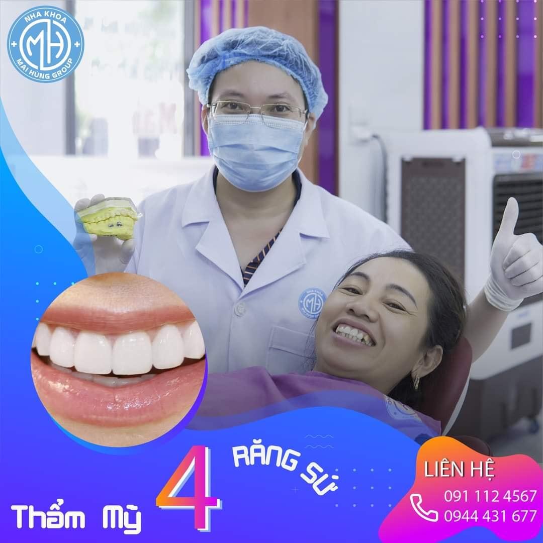6 địa chỉ phòng khám nha khoa đáng tin cậy và chất lượng hàng đầu tại Hà Tĩnh