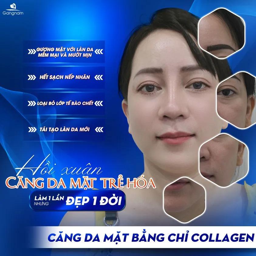 8 địa chỉ căng da mặt bằng chỉ chất lượng nhất tại TP. Hồ Chí Minh