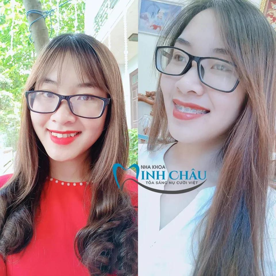 Top 9 Phòng Khám Nha Khoa Uy Tín Nhất Tại Quận Nam Từ Liêm, Hà Nội