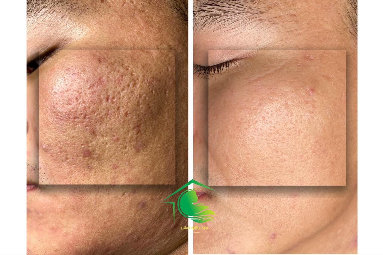 Top 9 địa chỉ spa làm đẹp đáng trải nghiệm nhất Vũng Tàu - Chất lượng đã được kiểm chứng