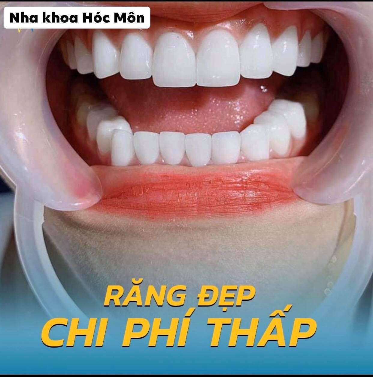 5 Phòng khám nha khoa chất lượng nhất tại Hóc Môn, TP. Hồ Chí Minh
