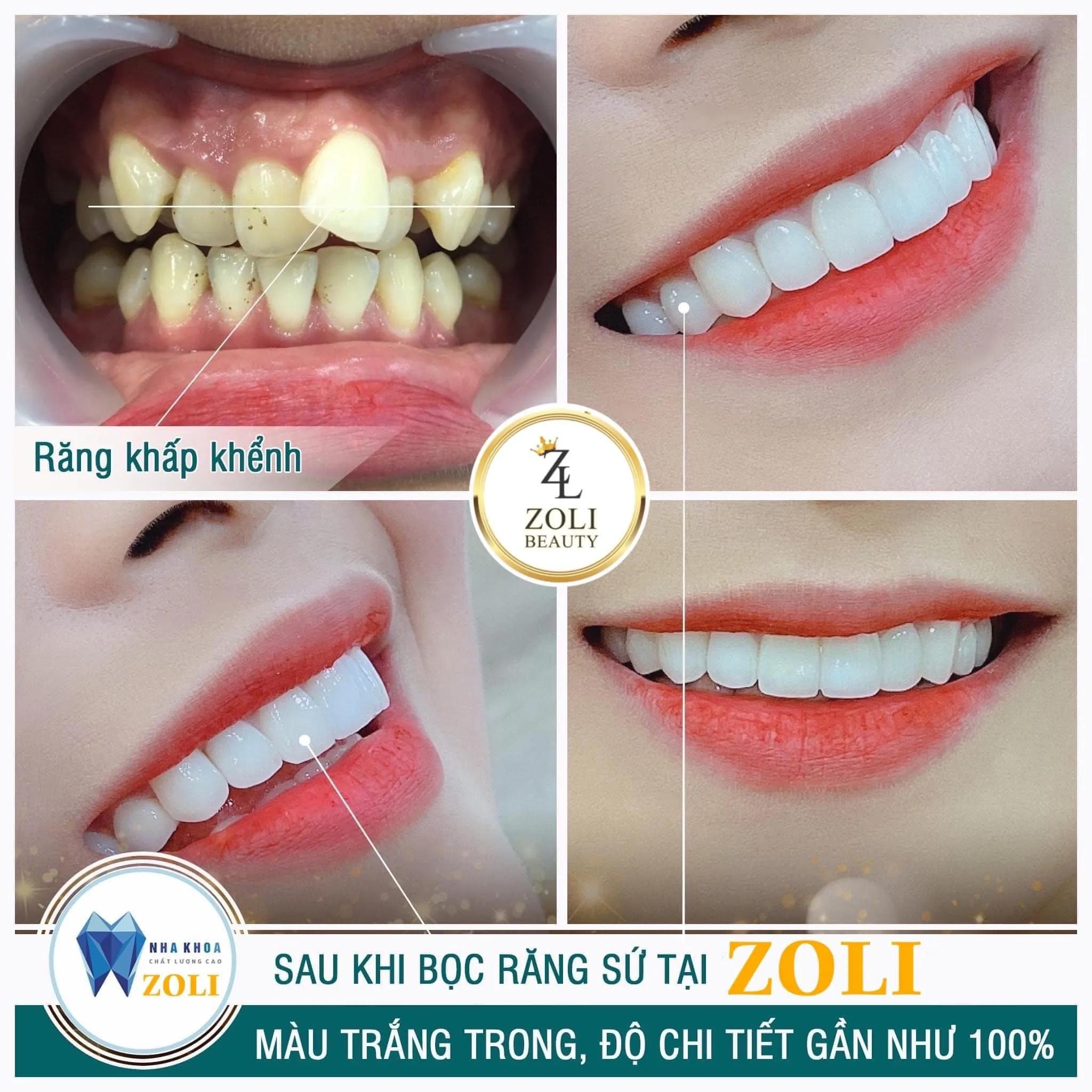 Top 4 Phòng khám nha khoa uy tín nhất tại quận Cái Răng, Cần Thơ