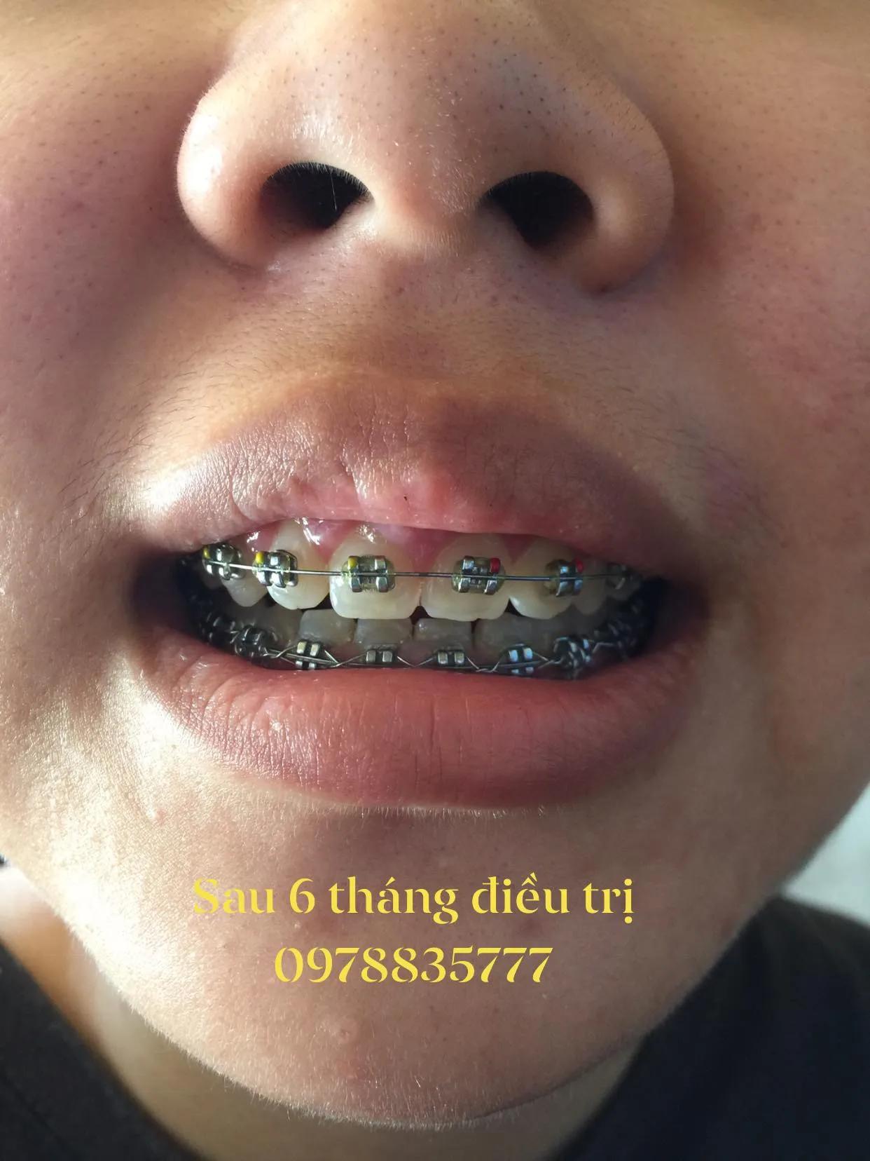Top 5 phòng khám nha khoa đáng tin cậy tại Đô Lương, Nghệ An