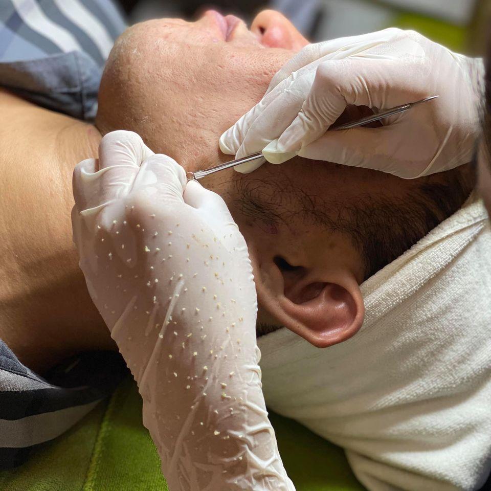 9 địa chỉ spa trị mụn hàng đầu tại Hải Phòng - Hiệu quả đã được kiểm chứng