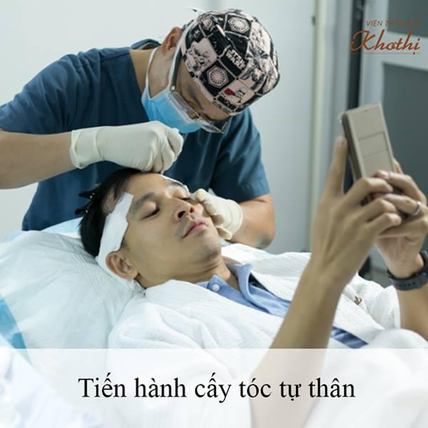 Top 6 địa chỉ cấy tóc uy tín nhất tại TP.HCM