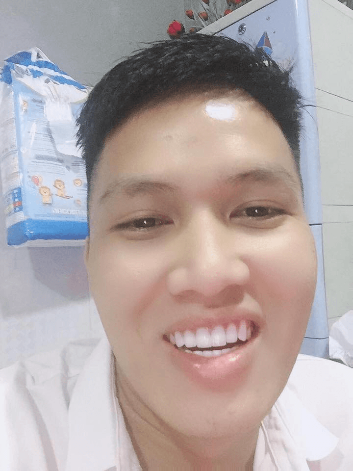 Top 5 Địa chỉ tẩy trắng răng uy tín tại Đà Lạt