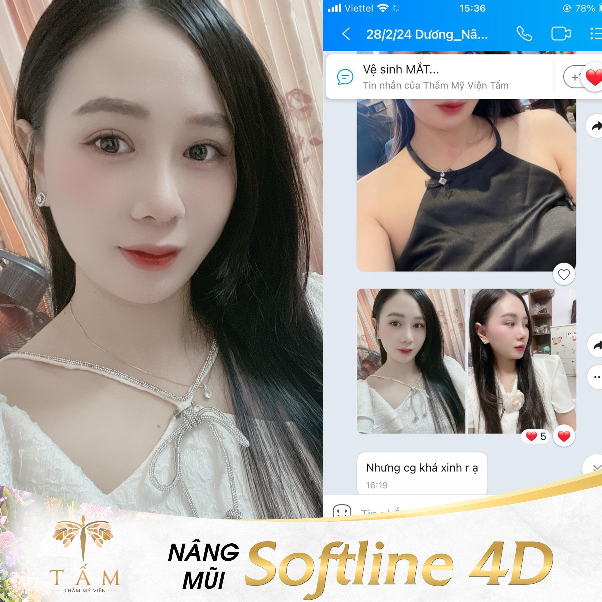 9 địa chỉ nâng mũi chất lượng, an toàn hàng đầu tại TP.HCM
