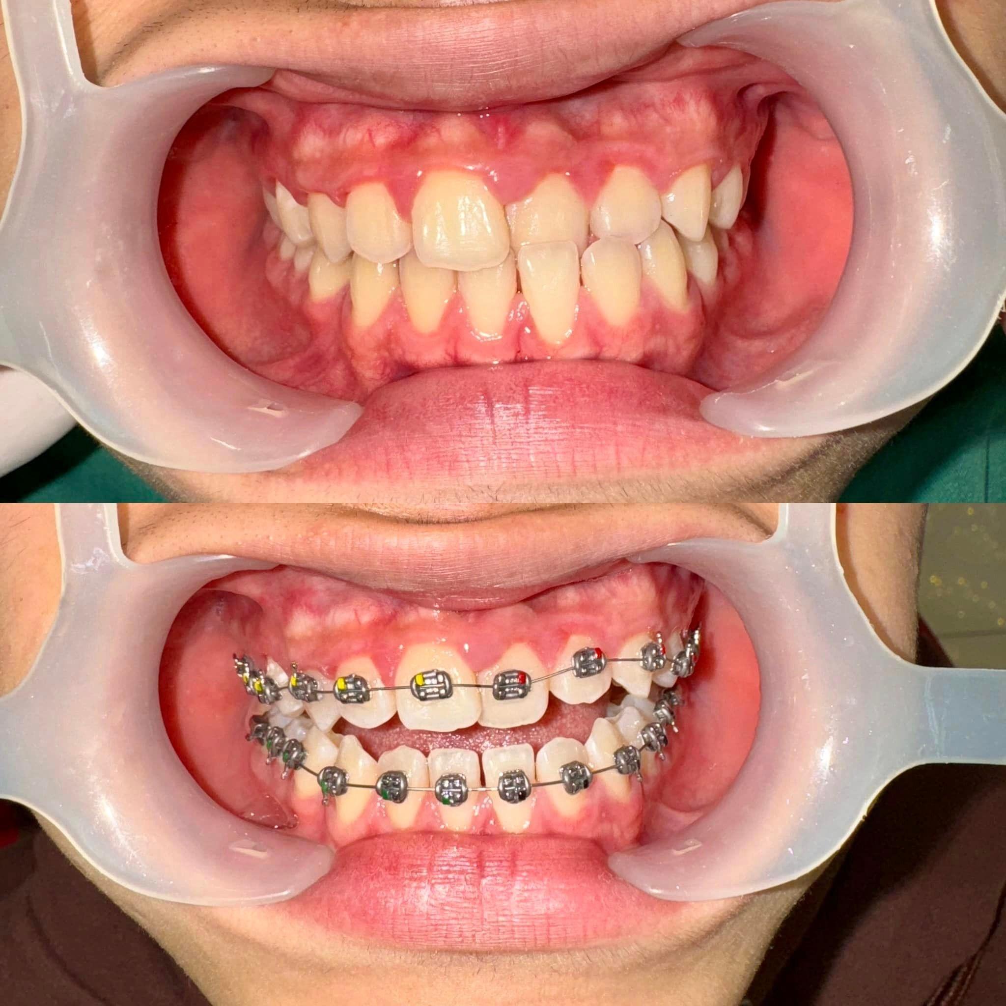 5 địa chỉ nha khoa chất lượng và uy tín hàng đầu tại Ba Vì, Hà Nội