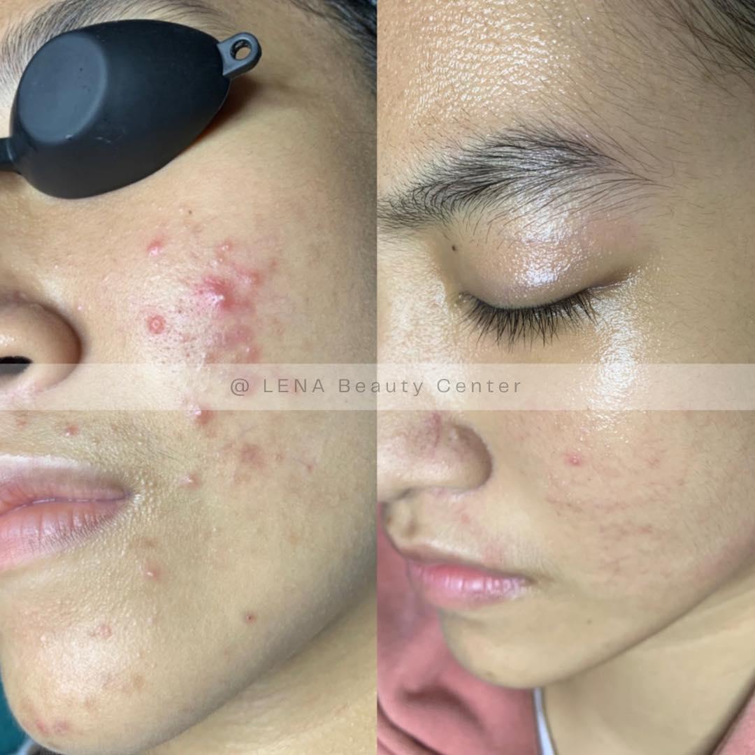 Top 5 Thẩm Mỹ Viện Nổi Bật Nhất Tại Trảng Bom và Tây Ninh