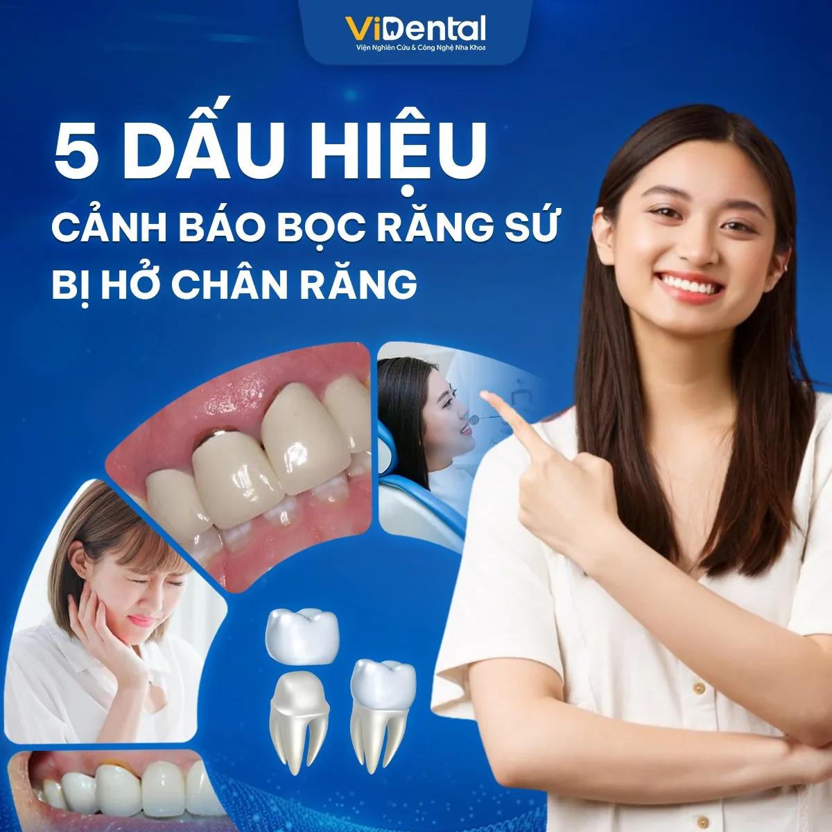 Top 6 địa chỉ bọc răng sứ thẩm mỹ uy tín nhất tại quận 1, TP.HCM