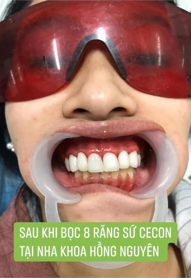 4 Địa chỉ nha khoa đáng tin cậy bậc nhất tại Sóc Trăng
