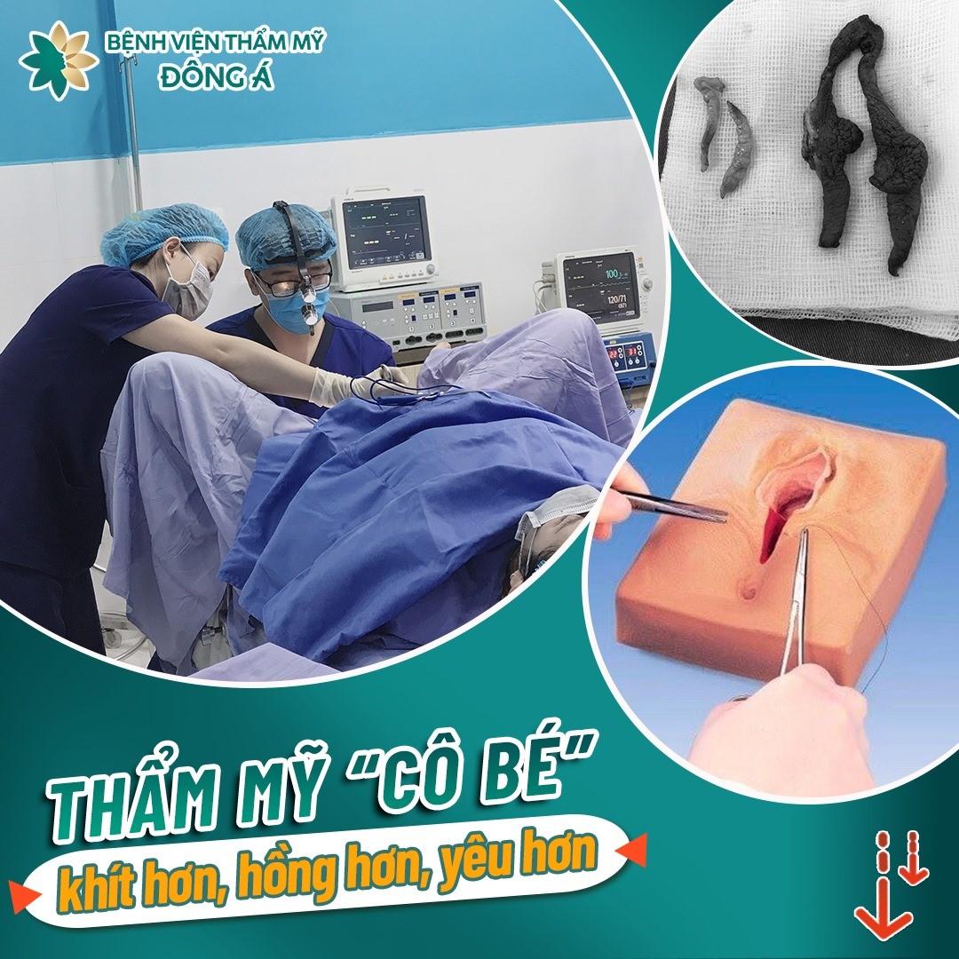 Top 5 Địa Chỉ Thẩm Mỹ Vùng Kín Chất Lượng & An Toàn Bậc Nhất Đà Nẵng