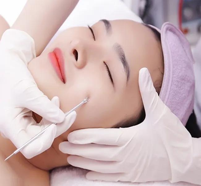 Top 5 Địa Chỉ Trị Mụn Hiệu Quả Nhất Tại TP. Long Xuyên, An Giang