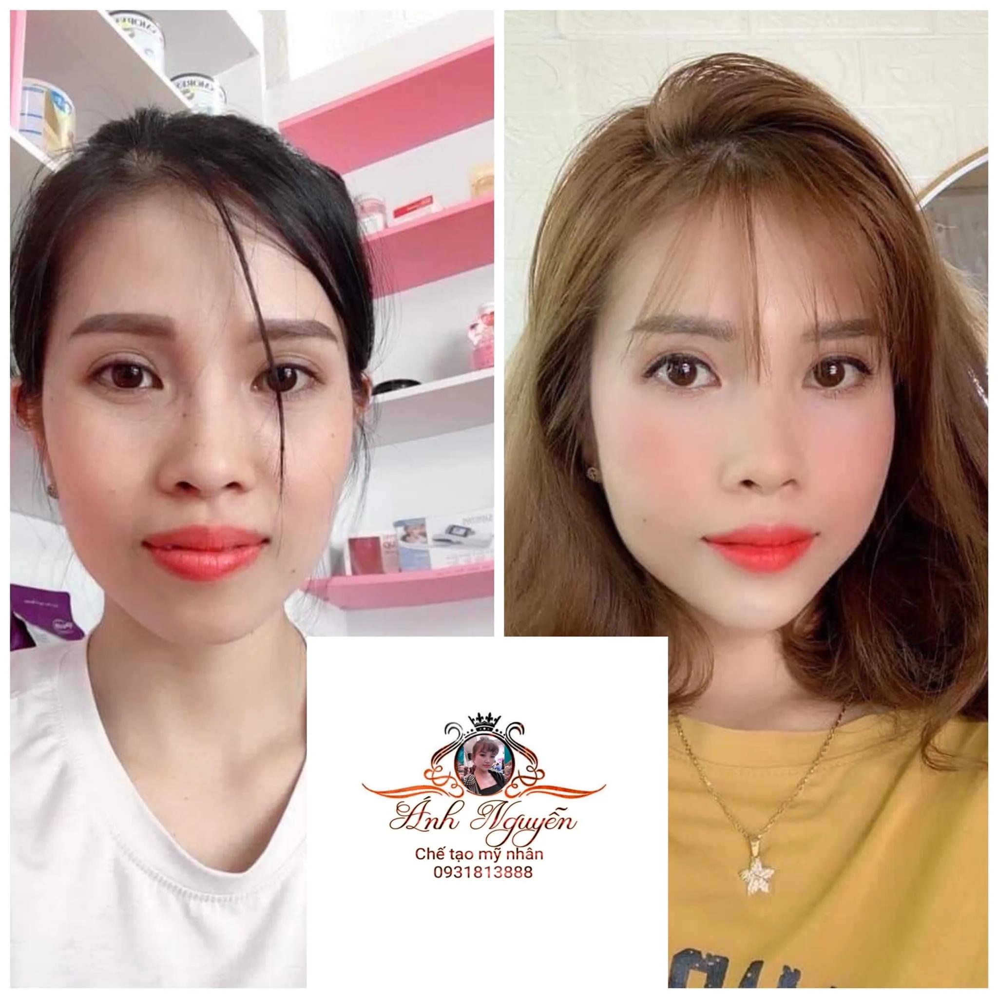 Top 10 Địa chỉ tiêm filler - botox đáng tin cậy và chất lượng tại Thái Nguyên