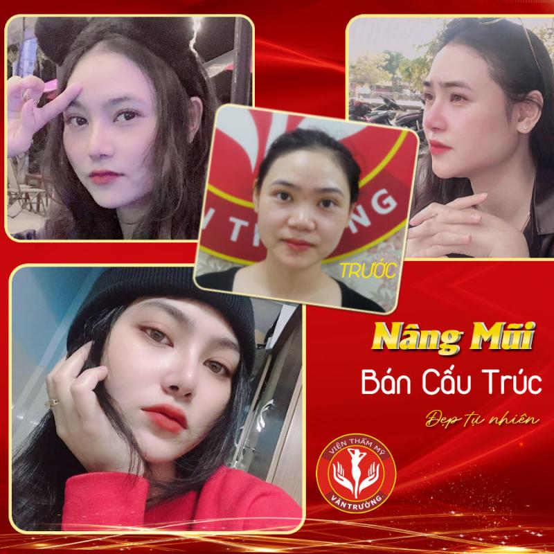 Top 9 Địa chỉ phẫu thuật thẩm mỹ chất lượng và uy tín tại Đà Nẵng