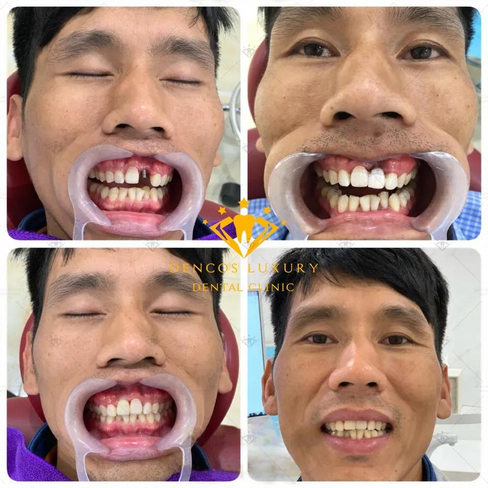 Top 9 phòng khám nha khoa uy tín tại Thanh Hóa