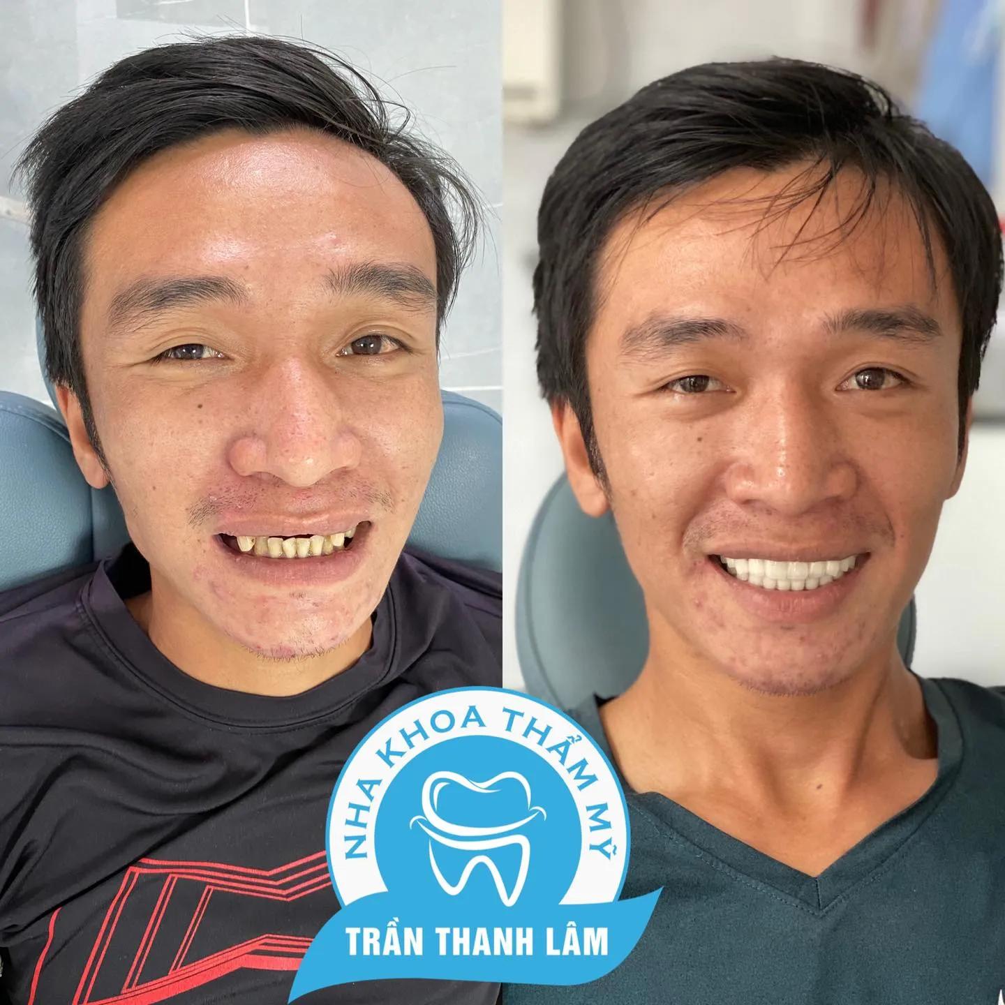 Top 5 địa chỉ niềng răng đáng tin cậy nhất tại Phú Quốc