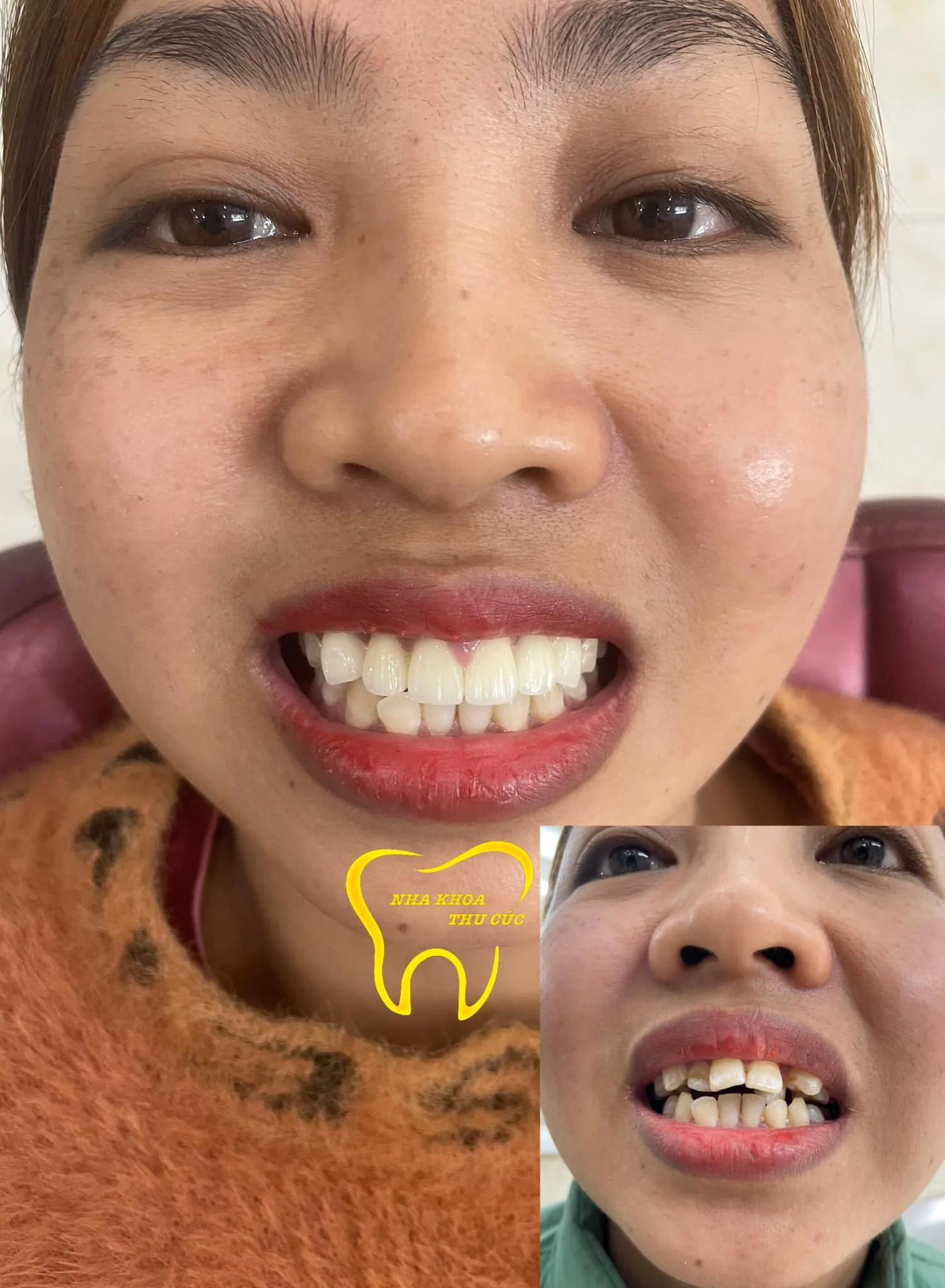 6 địa chỉ phòng khám nha khoa đáng tin cậy bậc nhất tại TP. Phúc Yên, Vĩnh Phúc