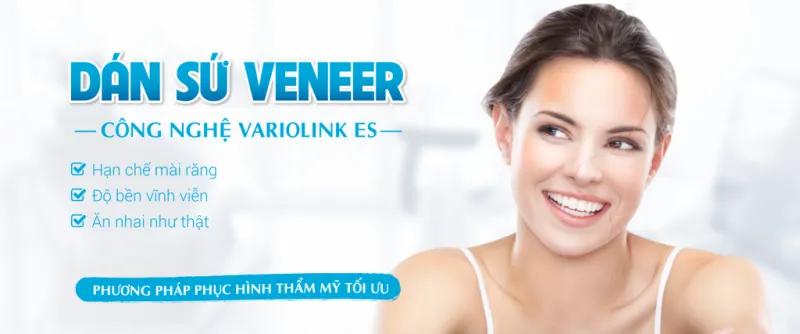 7 Địa chỉ nha khoa dán sứ veneer chất lượng nhất Đà Nẵng