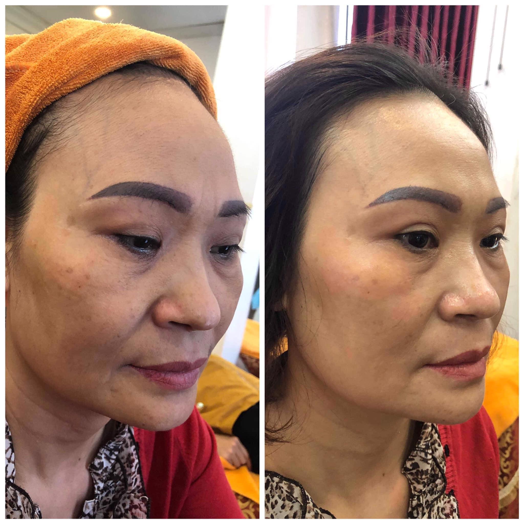 Khám phá 5 thẩm mỹ viện hàng đầu tại Thanh Hóa chuyên cung cấp dịch vụ trẻ hóa da mặt và làm căng bóng làn da uy tín.