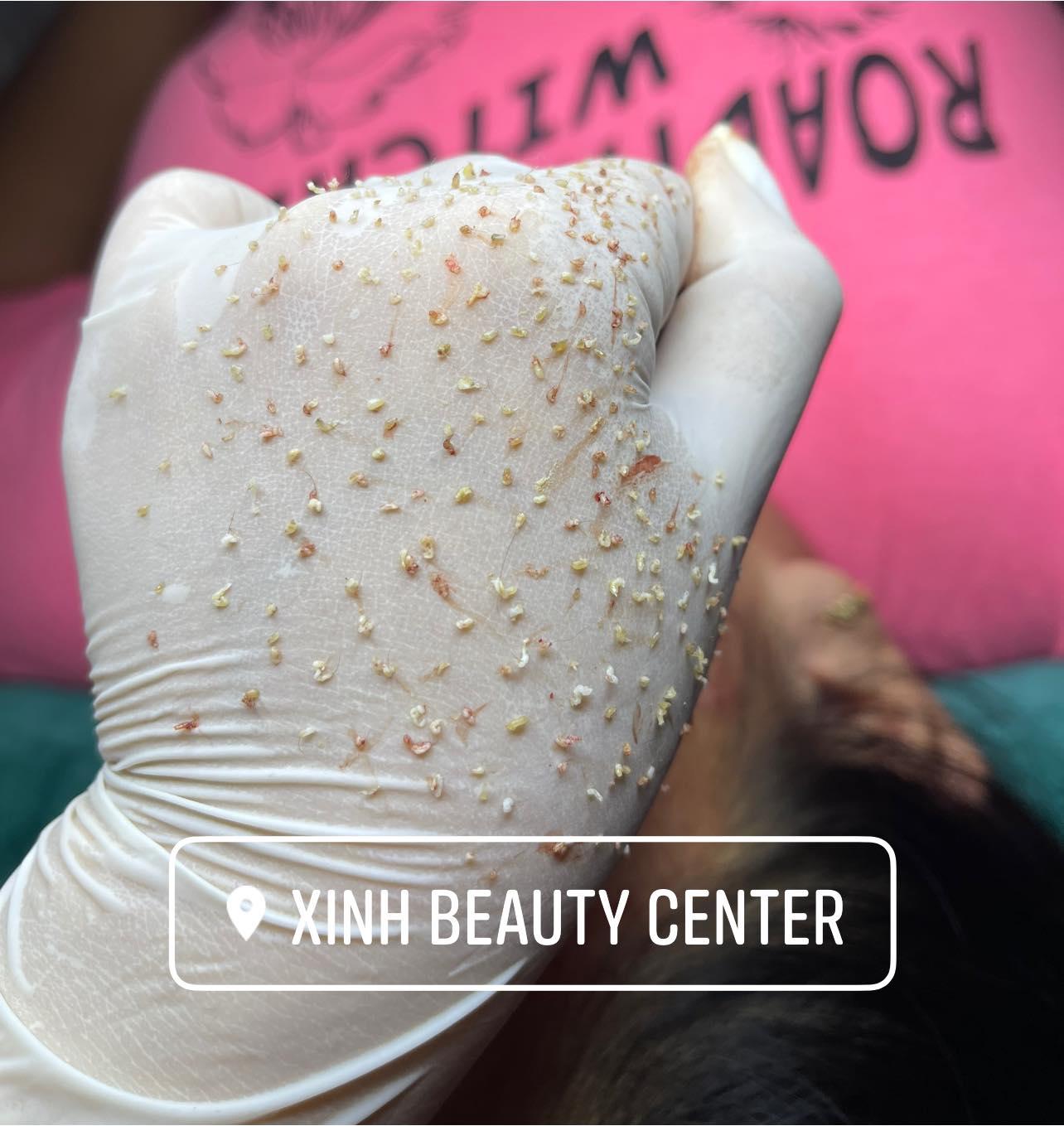 7 Spa trị mụn chất lượng nhất tại Trảng Bàng, Tây Ninh - Đánh giá chi tiết