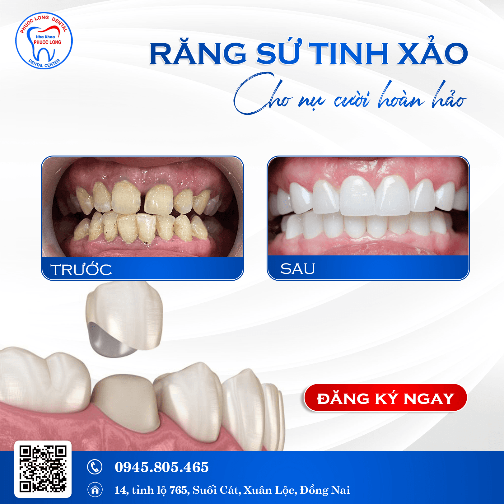 Top 5 Phòng Khám Nha Khoa Uy Tín Nhất Tại Xuân Lộc, Đồng Nai