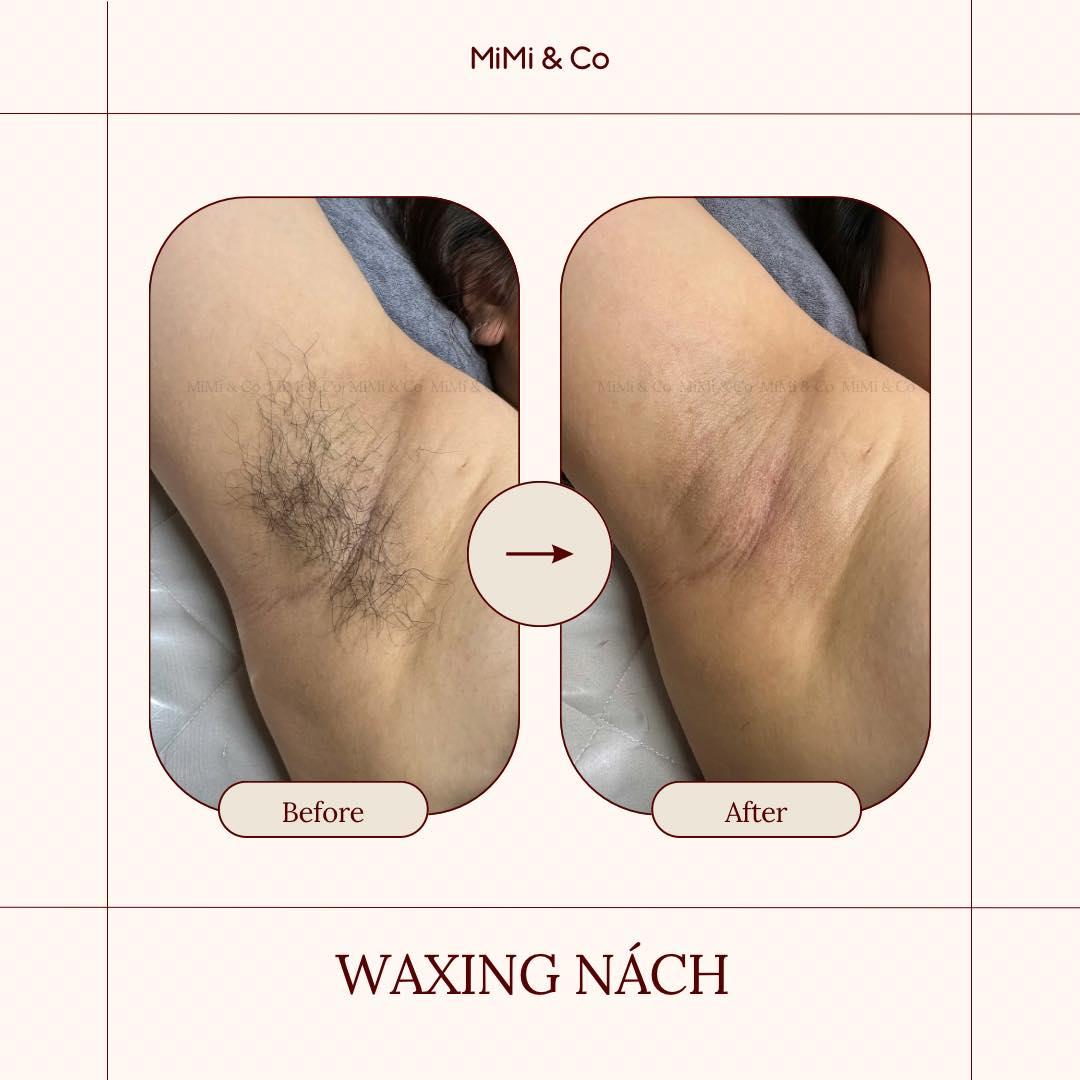 Top 5 địa chỉ waxing lông uy tín và hiệu quả nhất tại quận 3, TP. HCM