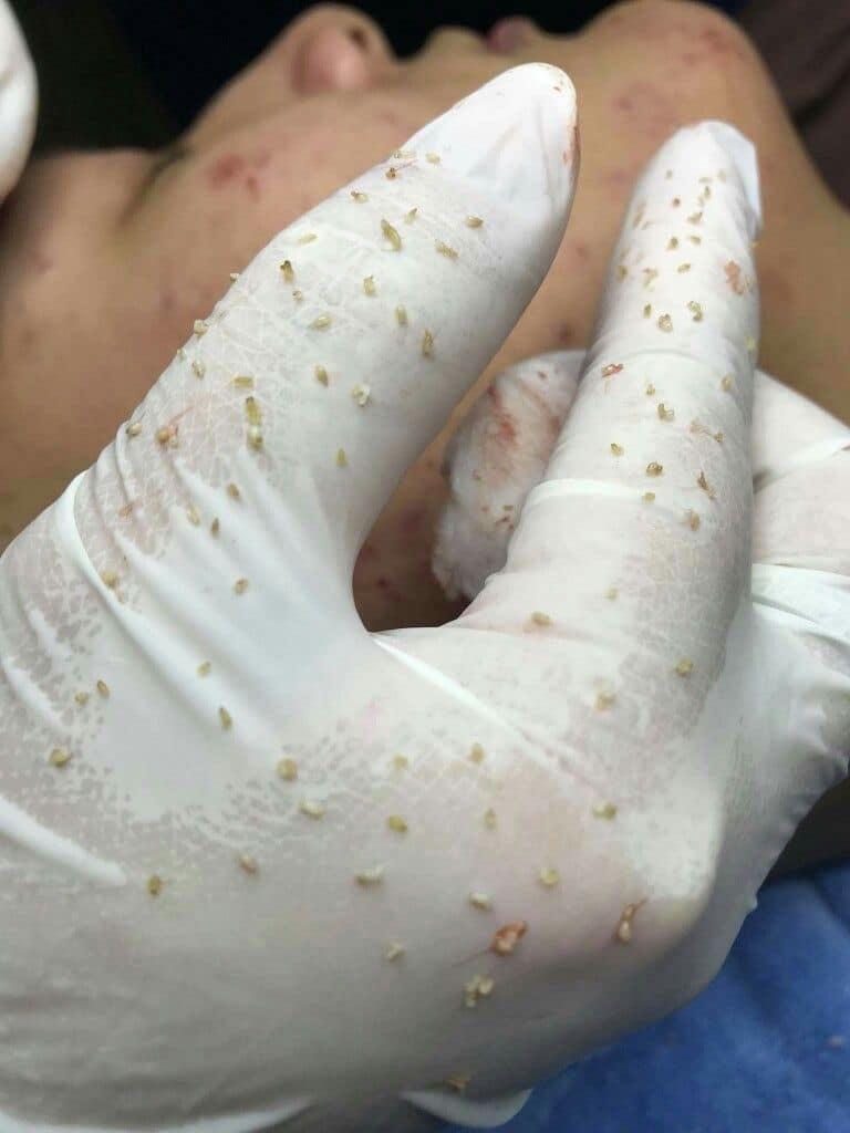 8 Địa chỉ Spa trị mụn chất lượng nhất tại Thọ Xuân, Thanh Hóa