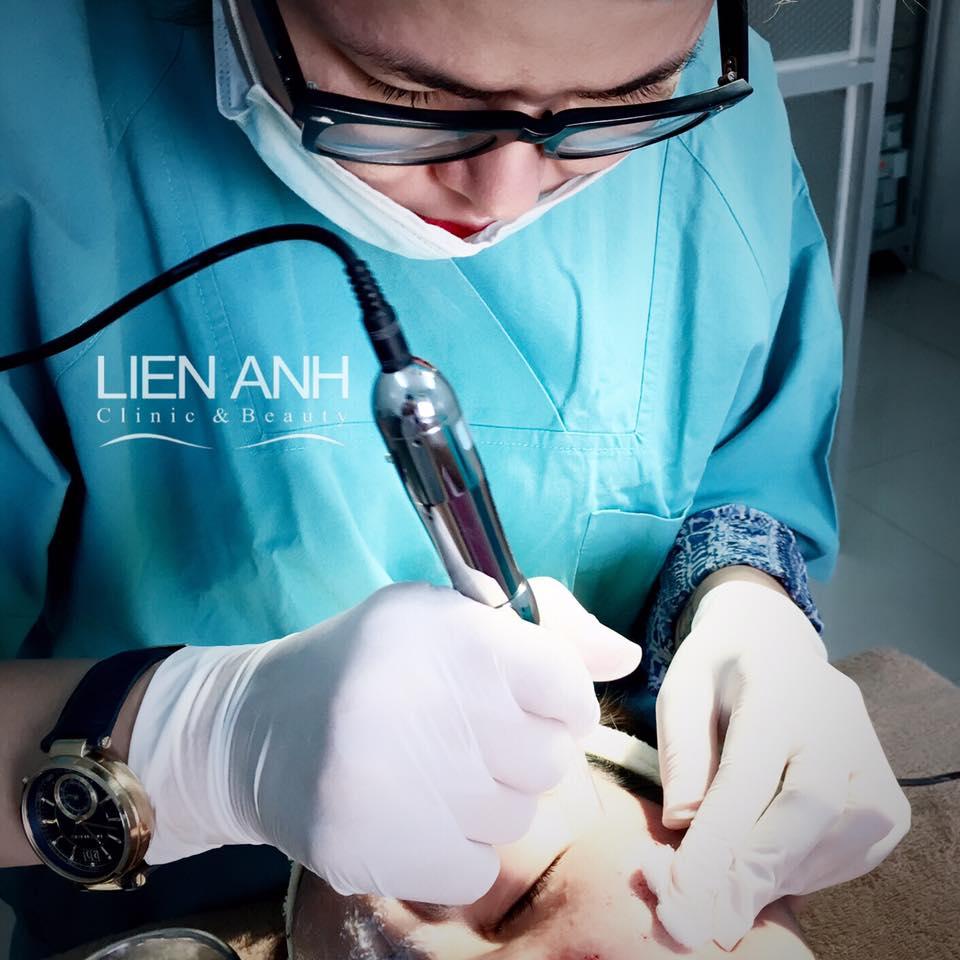 8 Địa điểm vàng điều trị sẹo rỗ/sẹo mụn đạt chuẩn y khoa tại Đà Nẵng