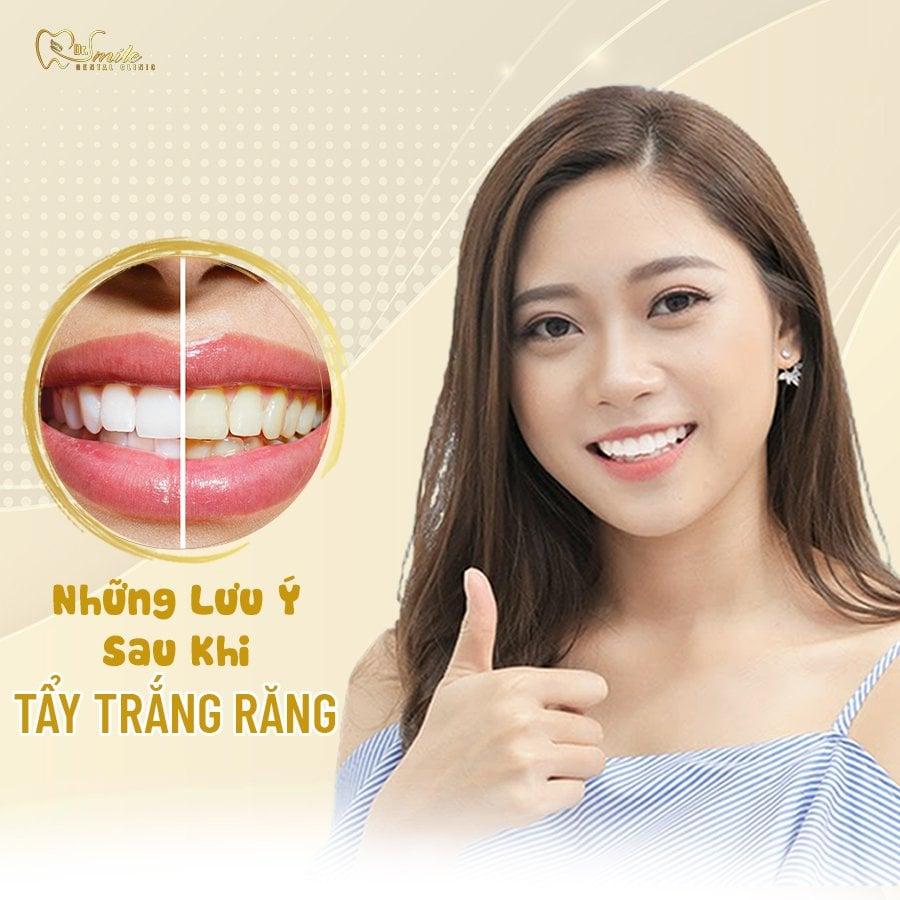 Khám Phá Top 5 Địa Chỉ Tẩy Trắng Răng Uy Tín Nhất Tại TP Rạch Giá, Kiên Giang