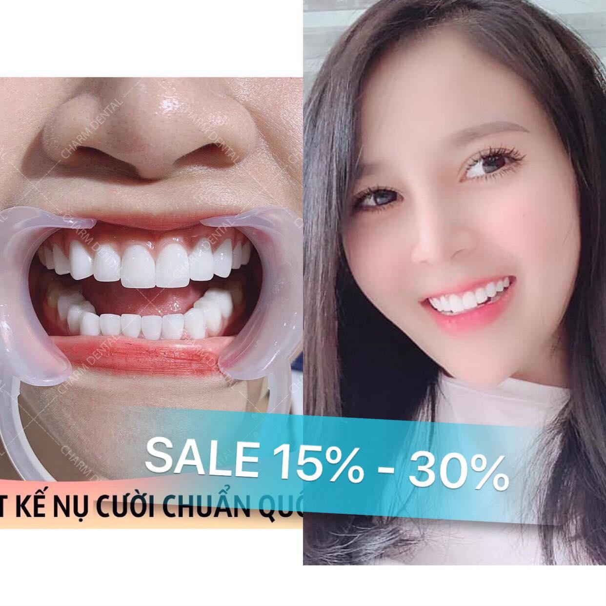 4 Địa chỉ tẩy trắng răng uy tín và hiệu quả nhất tại Cao Bằng