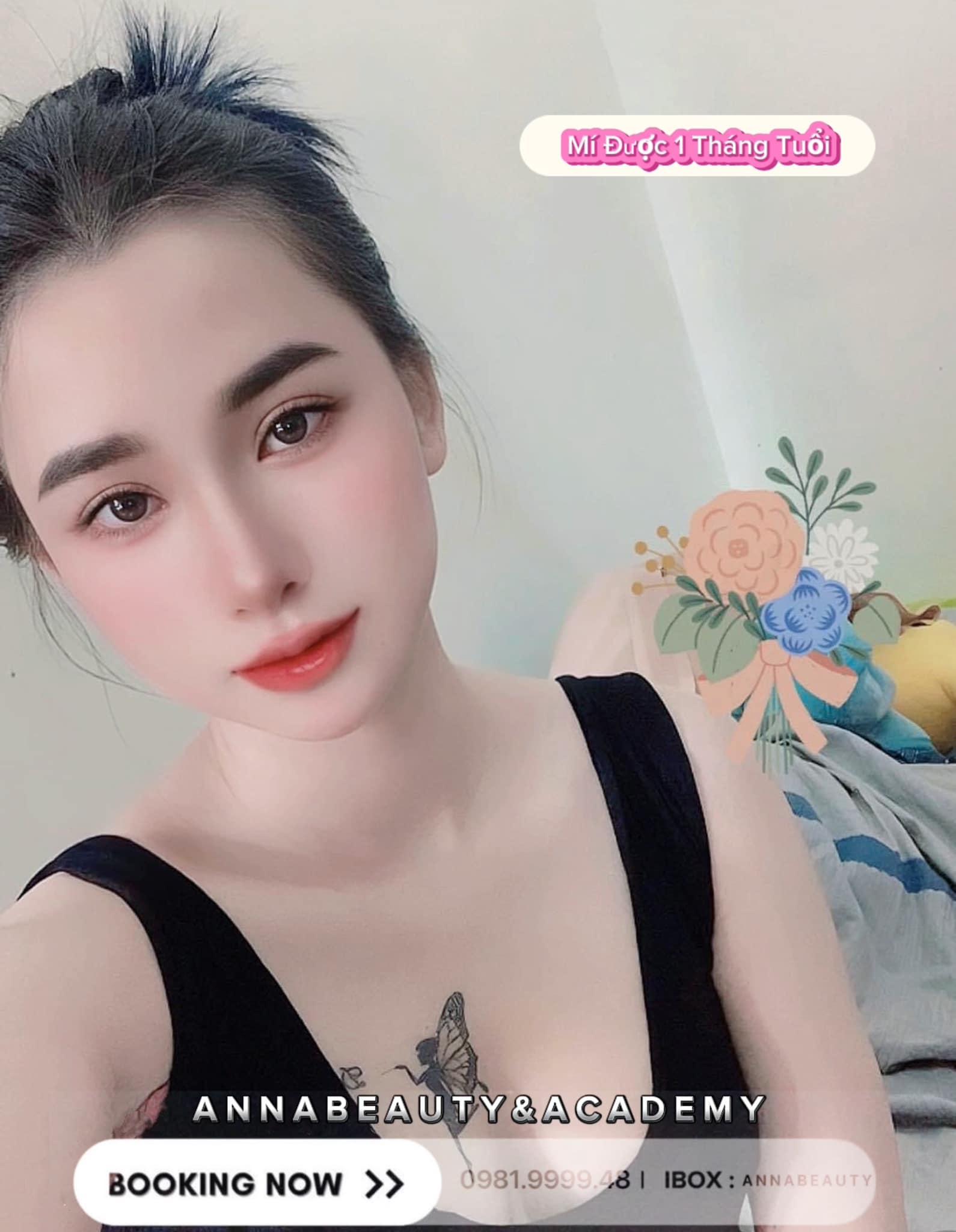 Top 4 Địa chỉ cắt mí mắt đẹp và uy tín tại Bến Tre