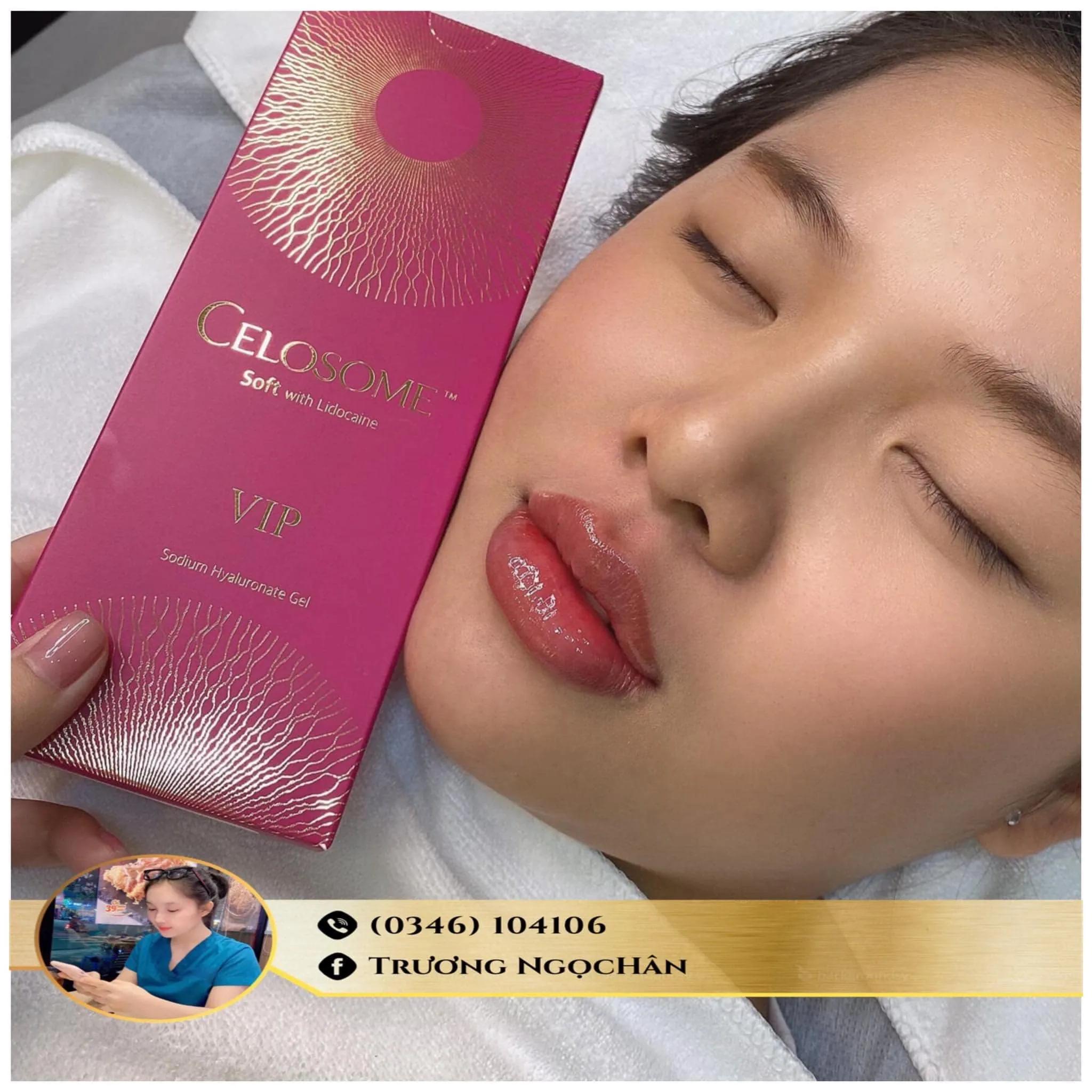 Top 6 địa chỉ tiêm Filler - Botox chất lượng và uy tín bậc nhất tại Tây Ninh