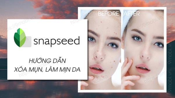 Bí kíp chỉnh ảnh chuyên nghiệp: Xóa mụn và làm mịn da hoàn hảo với Snapseed