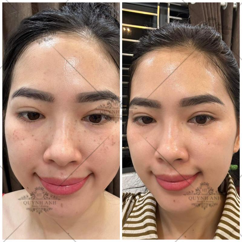 7 Spa chăm sóc da đáng trải nghiệm nhất tại quận Tân Bình, TP.HCM - Sự hài lòng vượt trội