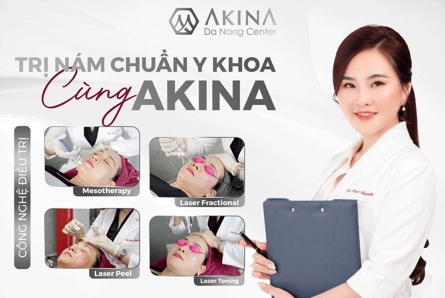 Top 7 địa chỉ điều trị nám, tàn nhang, đồi mồi hiệu quả tại Đà Nẵng