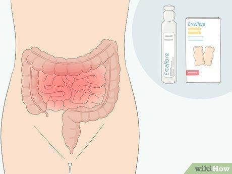 Hướng dẫn cách sử dụng Erceflora hiệu quả