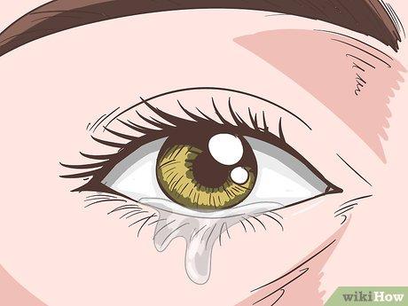 Cách Điều Trị Khô Mắt Hiệu Quả